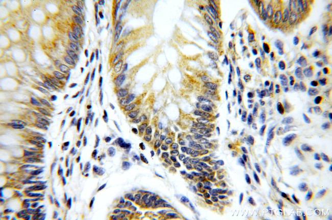 PIGZ Antibody in Immunohistochemistry (Paraffin) (IHC (P))