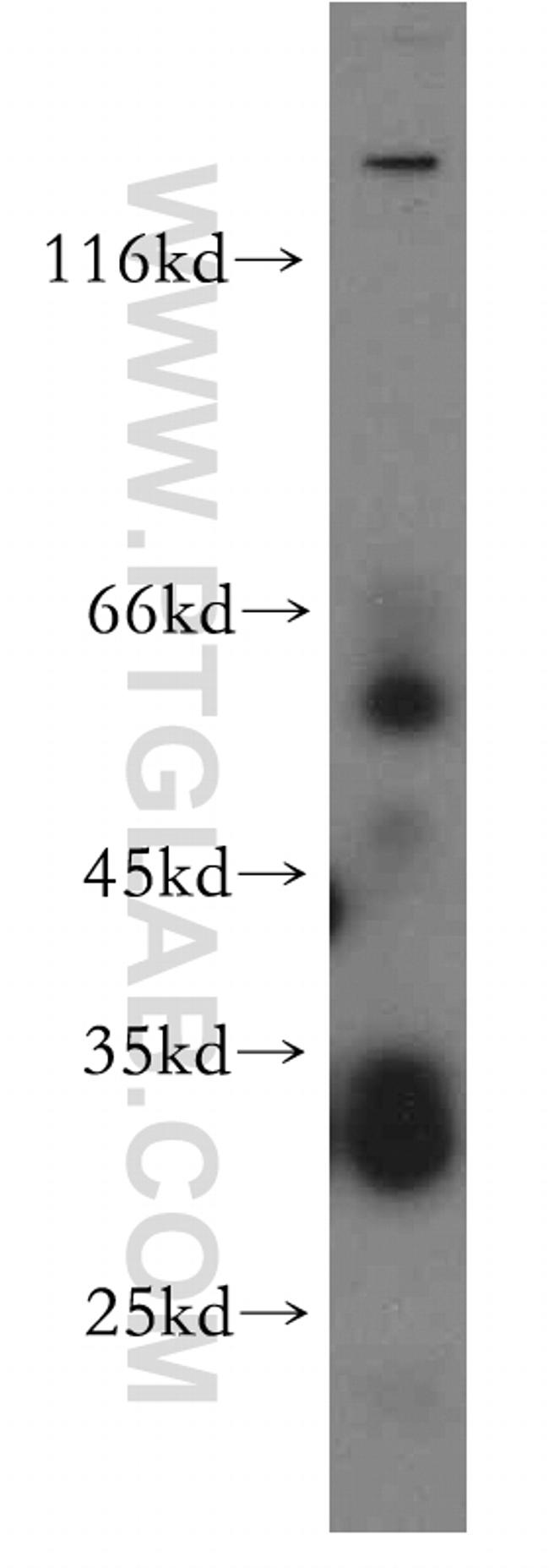 PIGZ Antibody in Western Blot (WB)