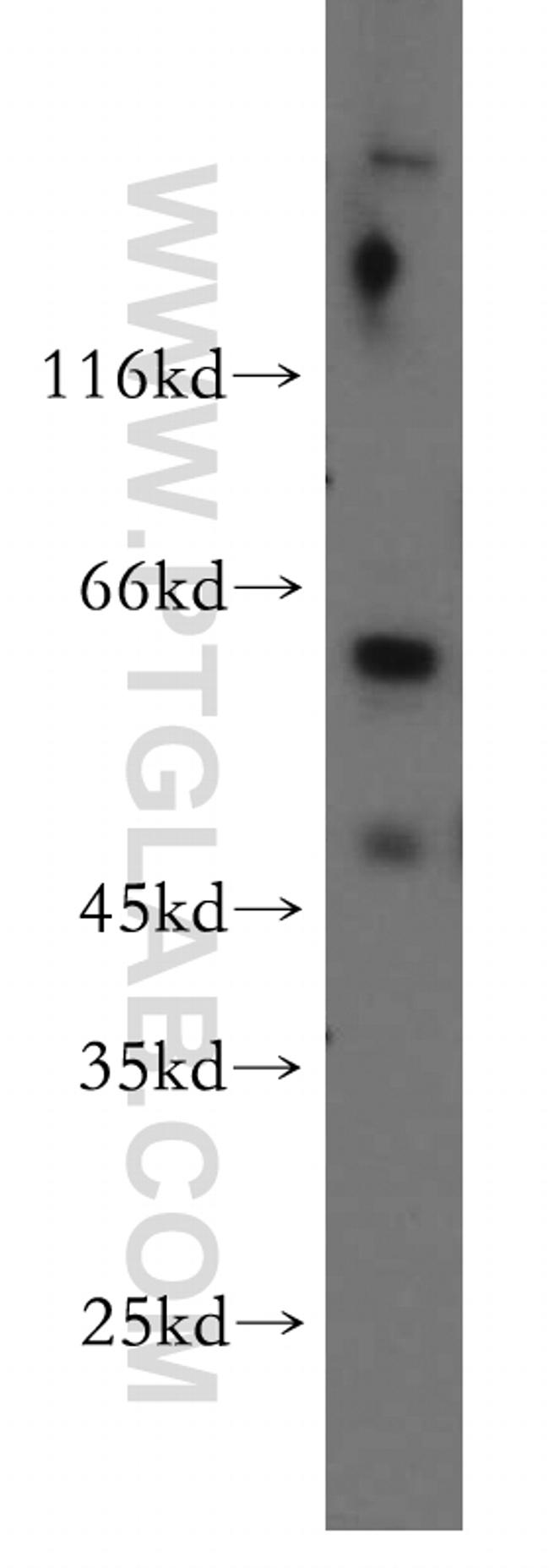 PIGZ Antibody in Western Blot (WB)