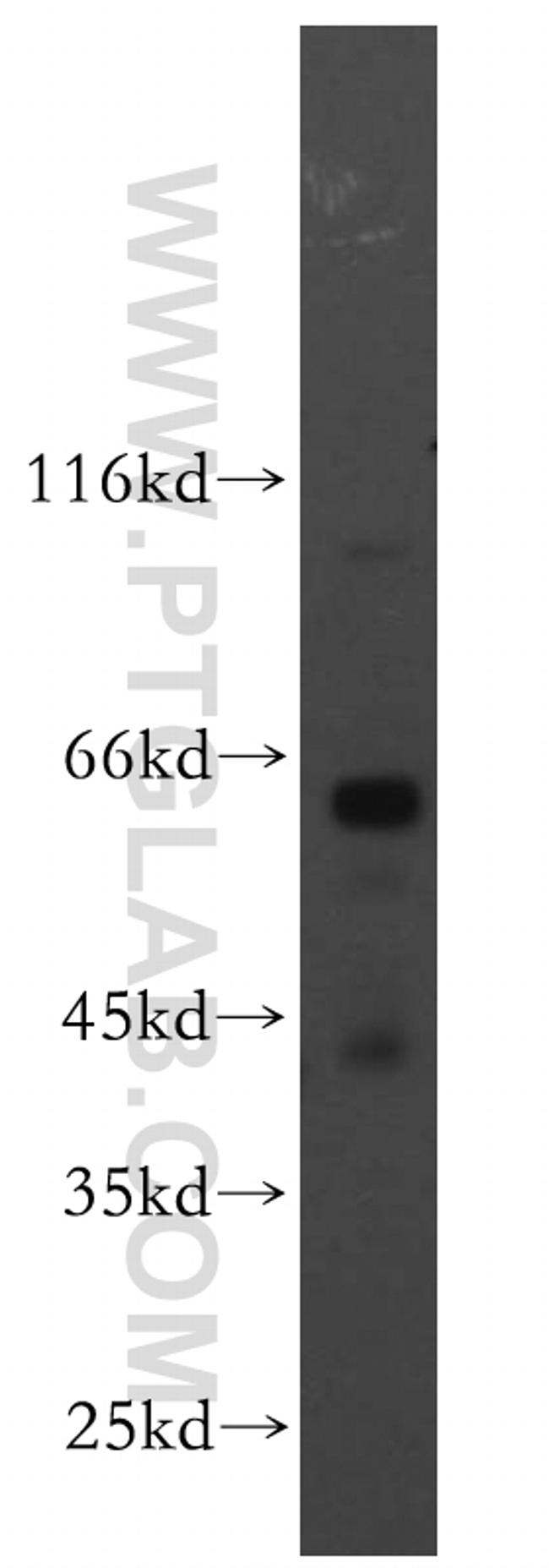 PIGZ Antibody in Western Blot (WB)