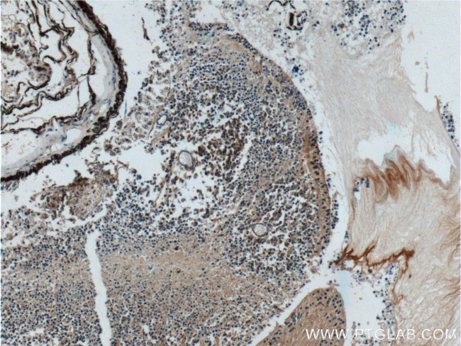 NRL Antibody in Immunohistochemistry (Paraffin) (IHC (P))