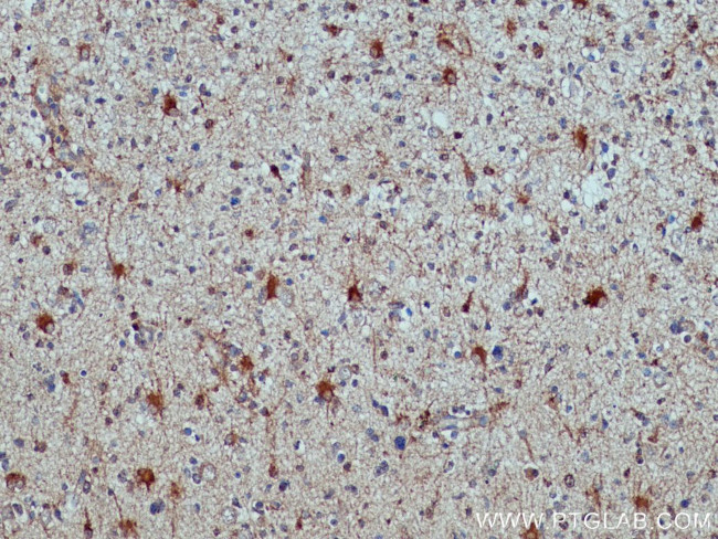 ALDH1L1 Antibody in Immunohistochemistry (Paraffin) (IHC (P))