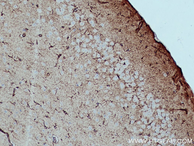 ALDH1L1 Antibody in Immunohistochemistry (Paraffin) (IHC (P))