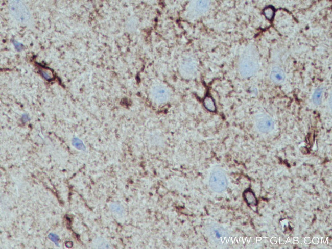 ALDH1L1 Antibody in Immunohistochemistry (Paraffin) (IHC (P))