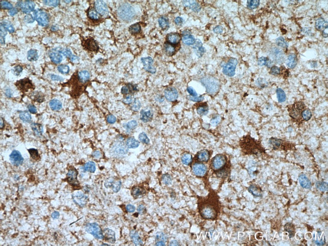 ALDH1L1 Antibody in Immunohistochemistry (Paraffin) (IHC (P))