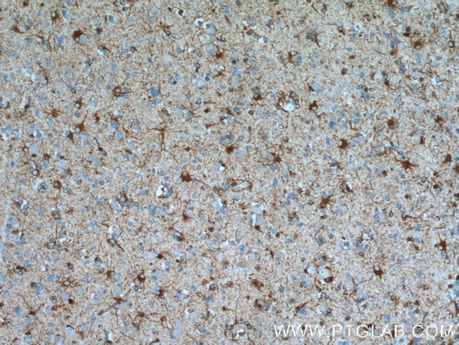 ALDH1L1 Antibody in Immunohistochemistry (Paraffin) (IHC (P))