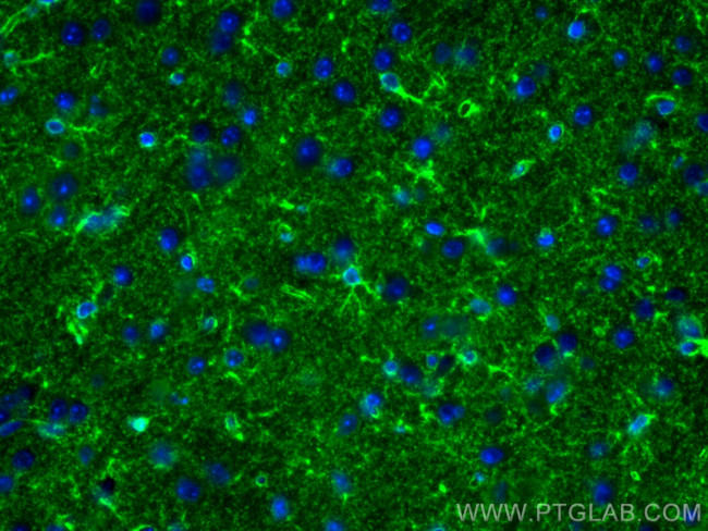 ALDH1L1 Antibody in Immunohistochemistry (PFA fixed) (IHC (PFA))