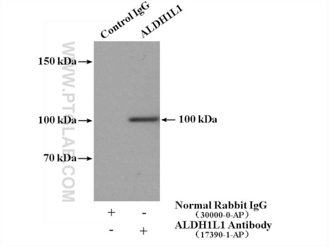 ALDH1L1 Antibody in Immunoprecipitation (IP)