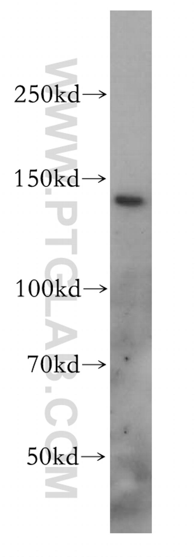 SLC9A11 Antibody in Western Blot (WB)