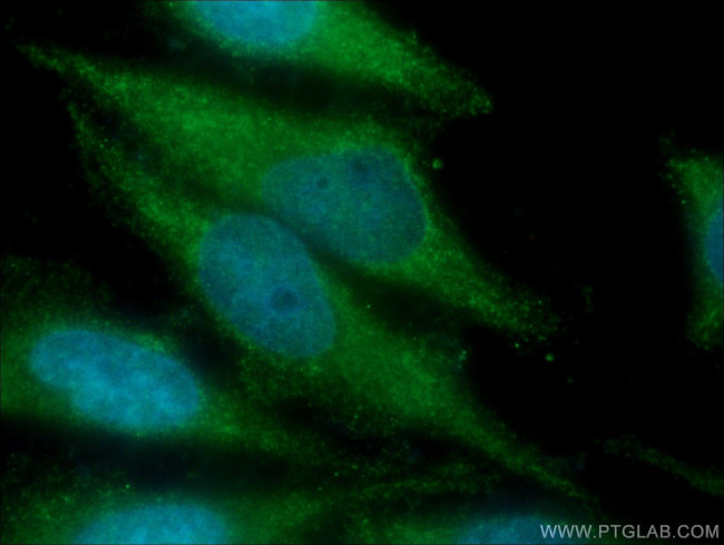 FGF1 Antibody in Immunocytochemistry (ICC/IF)