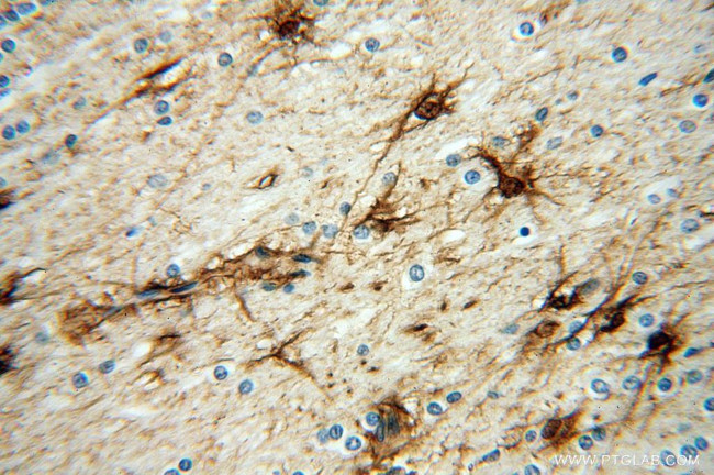 FGF1 Antibody in Immunohistochemistry (Paraffin) (IHC (P))