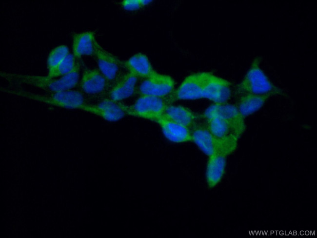 RPAP2 Antibody in Immunocytochemistry (ICC/IF)