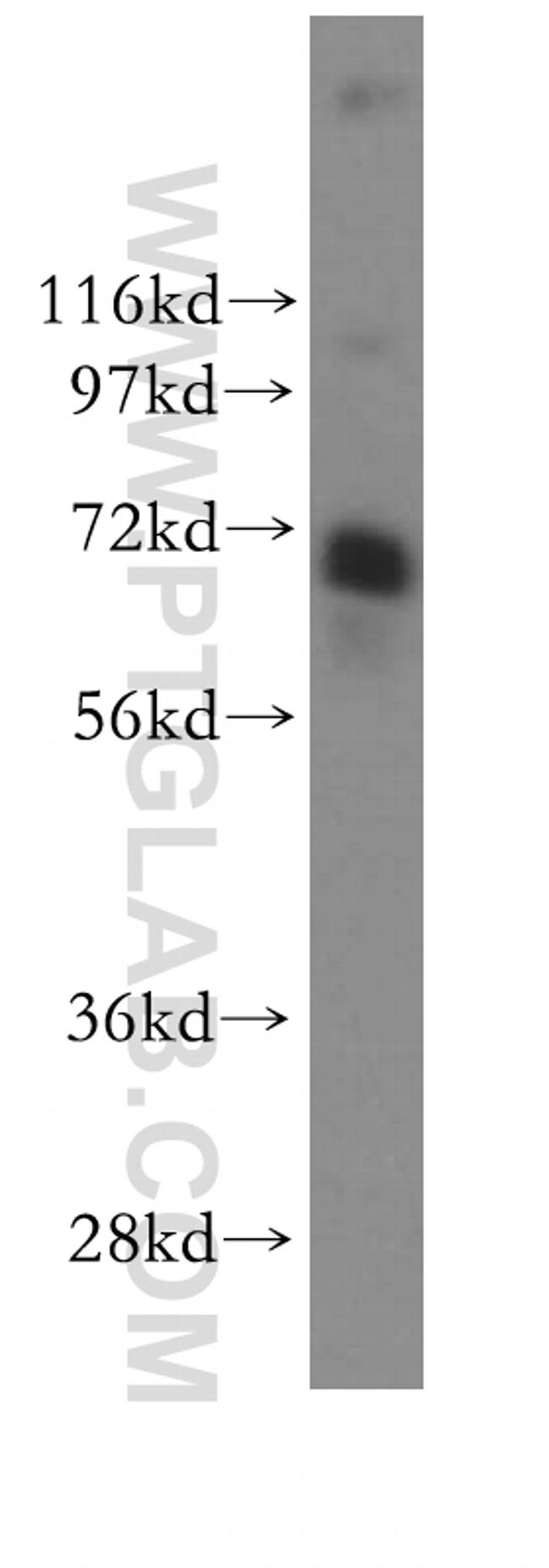 RPAP2 Antibody in Western Blot (WB)