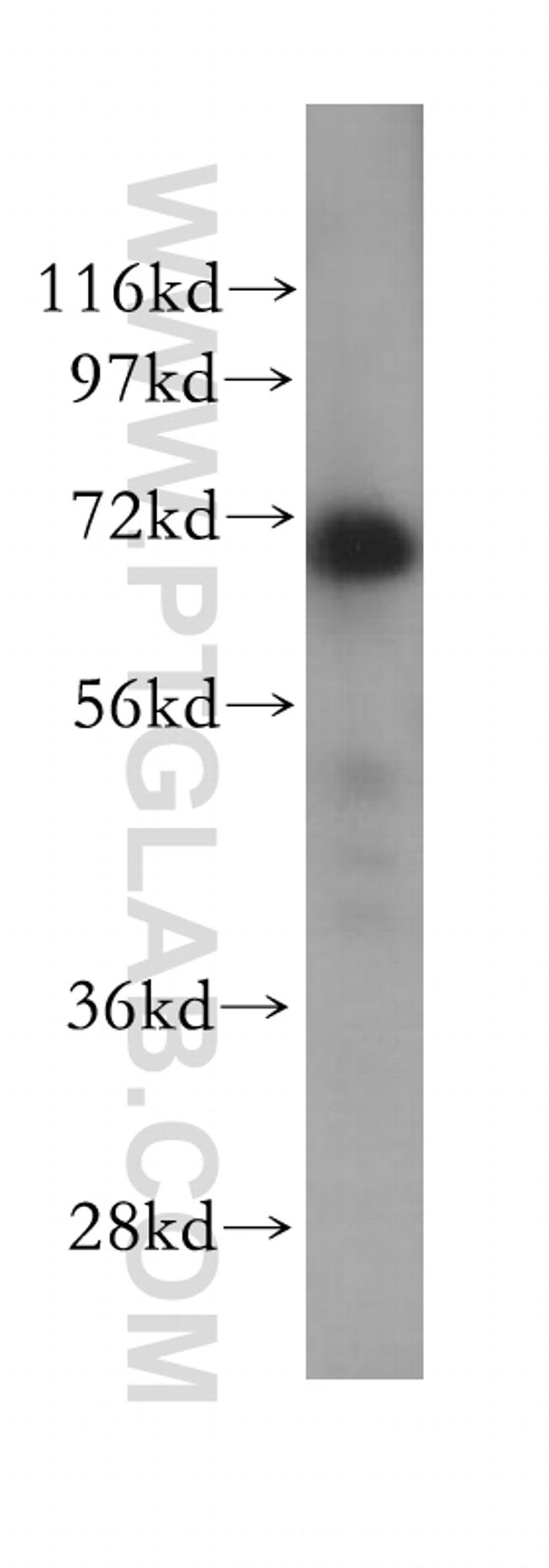 RPAP2 Antibody in Western Blot (WB)