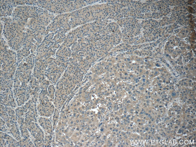 CXCL12/SDF-1 Antibody in Immunohistochemistry (Paraffin) (IHC (P))