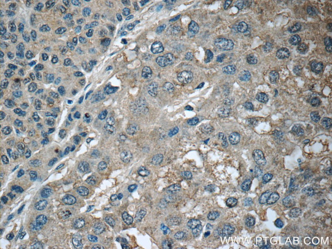 CXCL12/SDF-1 Antibody in Immunohistochemistry (Paraffin) (IHC (P))