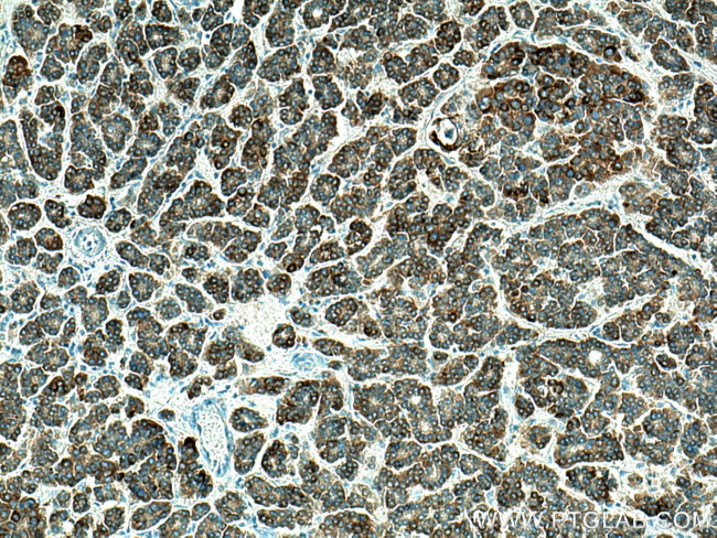 CXCL12/SDF-1 Antibody in Immunohistochemistry (Paraffin) (IHC (P))