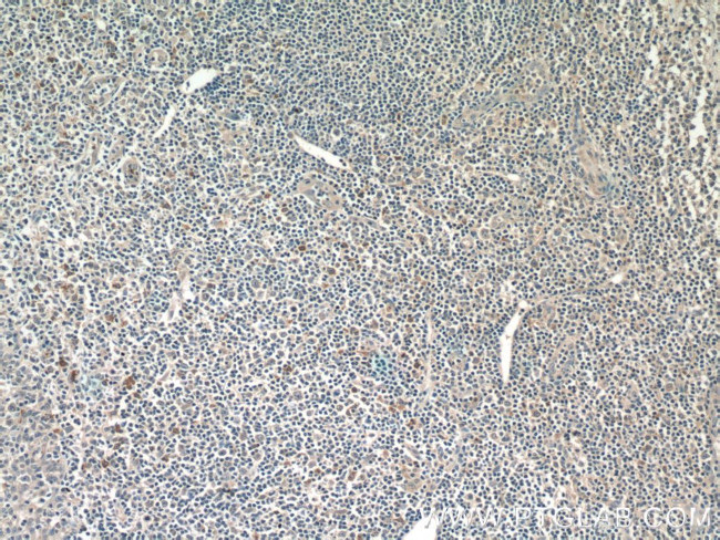 CXCL12/SDF-1 Antibody in Immunohistochemistry (Paraffin) (IHC (P))