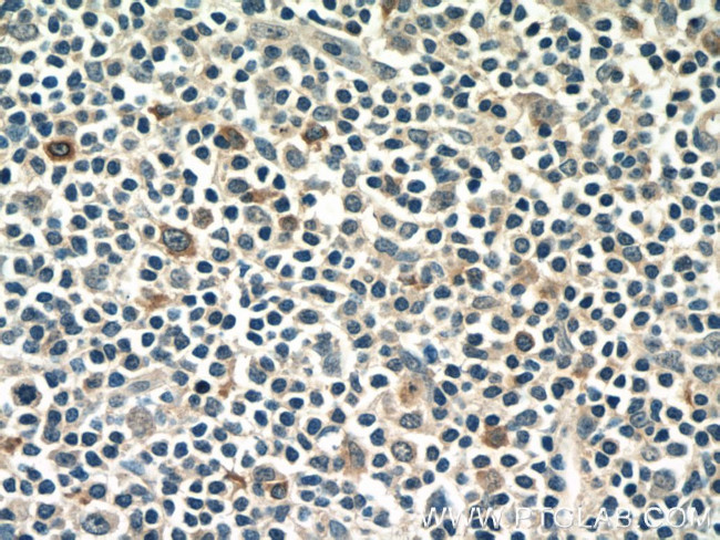 CXCL12/SDF-1 Antibody in Immunohistochemistry (Paraffin) (IHC (P))