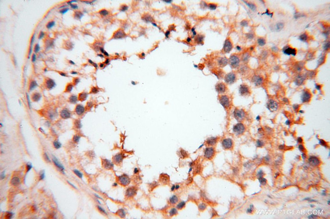 PDCL2 Antibody in Immunohistochemistry (Paraffin) (IHC (P))