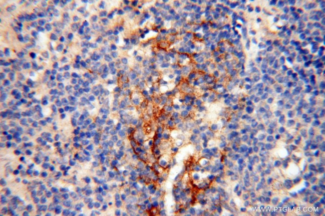 PDCL2 Antibody in Immunohistochemistry (Paraffin) (IHC (P))