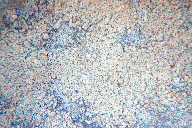 PDCL2 Antibody in Immunohistochemistry (Paraffin) (IHC (P))