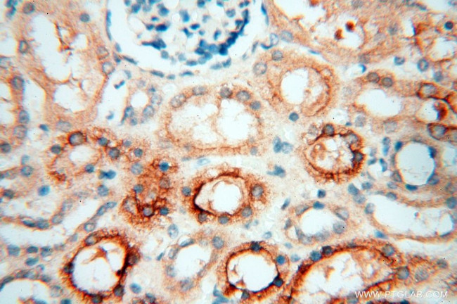 PDCL2 Antibody in Immunohistochemistry (Paraffin) (IHC (P))