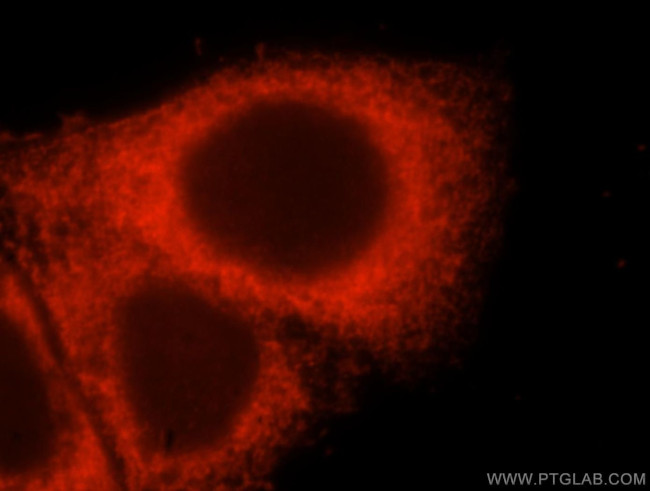 EVI2A Antibody in Immunocytochemistry (ICC/IF)