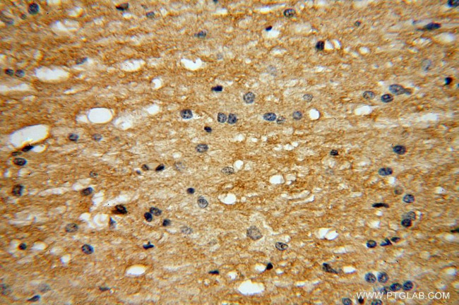 EVI2A Antibody in Immunohistochemistry (Paraffin) (IHC (P))