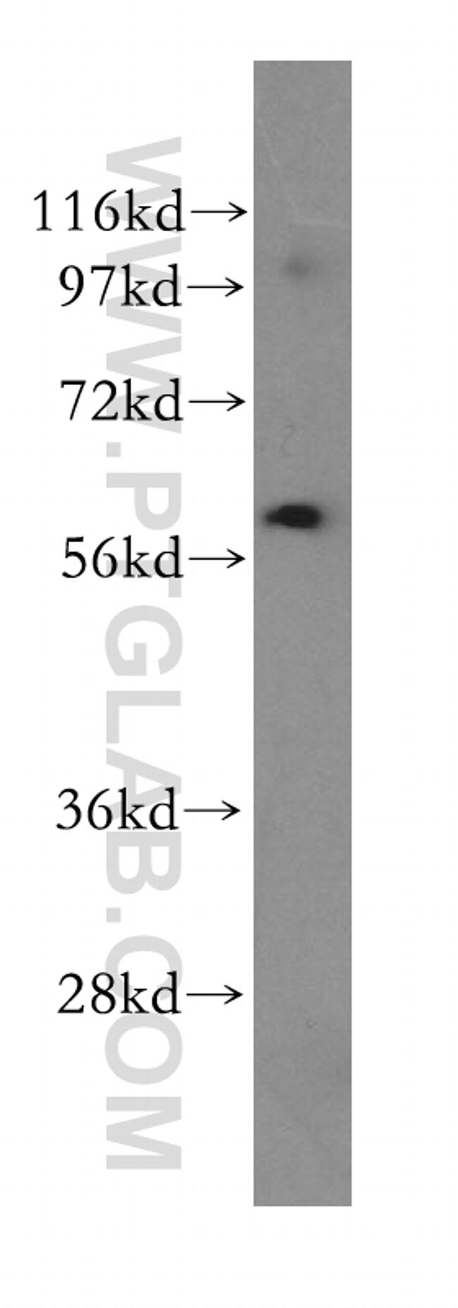 UTP15 Antibody in Western Blot (WB)