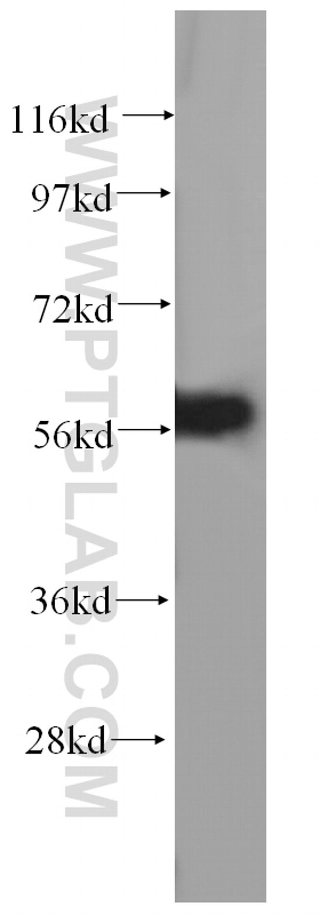 UTP15 Antibody in Western Blot (WB)