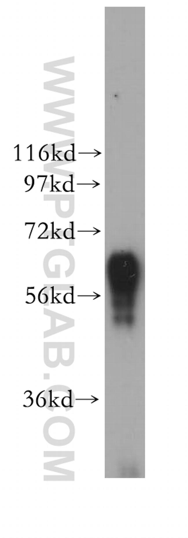 CSGALNACT2 Antibody in Western Blot (WB)