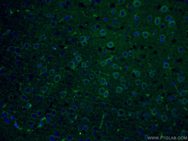 PLCL2 Antibody in Immunohistochemistry (Paraffin) (IHC (P))