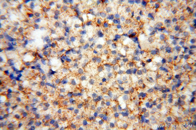 CD33 Antibody in Immunohistochemistry (Paraffin) (IHC (P))