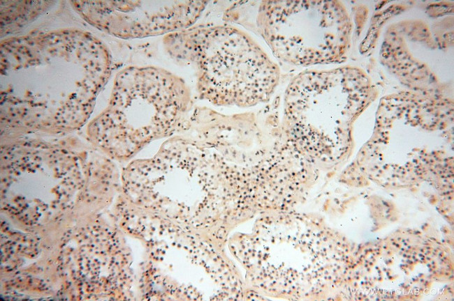 CD33 Antibody in Immunohistochemistry (Paraffin) (IHC (P))