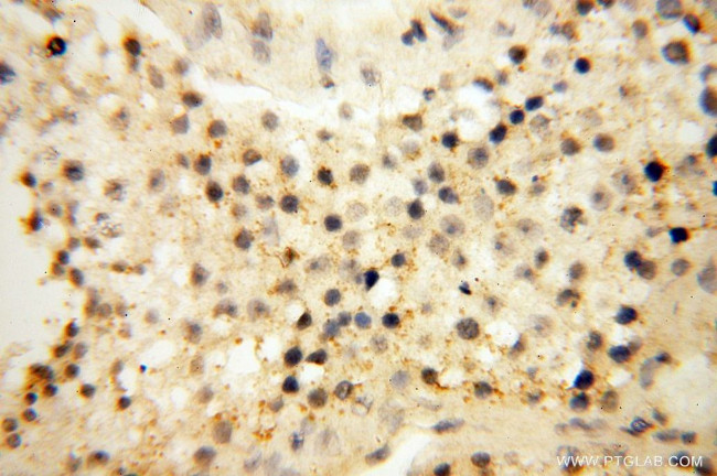 CD33 Antibody in Immunohistochemistry (Paraffin) (IHC (P))