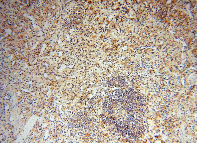 CD33 Antibody in Immunohistochemistry (Paraffin) (IHC (P))