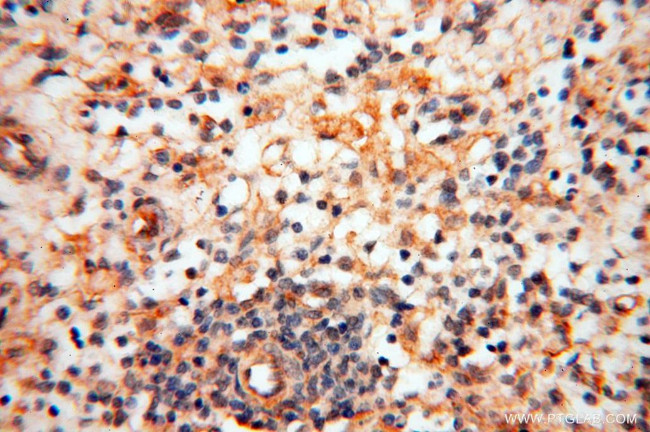 CD33 Antibody in Immunohistochemistry (Paraffin) (IHC (P))