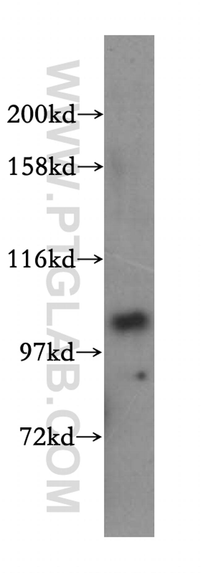 NARG1L Antibody in Western Blot (WB)