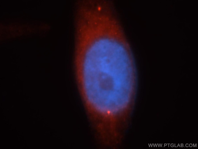 MAGT1 Antibody in Immunocytochemistry (ICC/IF)