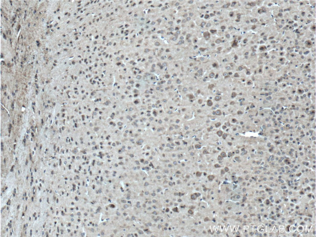 MAGT1 Antibody in Immunohistochemistry (Paraffin) (IHC (P))