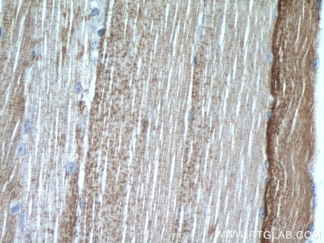 MAGT1 Antibody in Immunohistochemistry (Paraffin) (IHC (P))