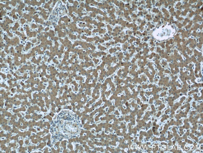 MAGT1 Antibody in Immunohistochemistry (Paraffin) (IHC (P))