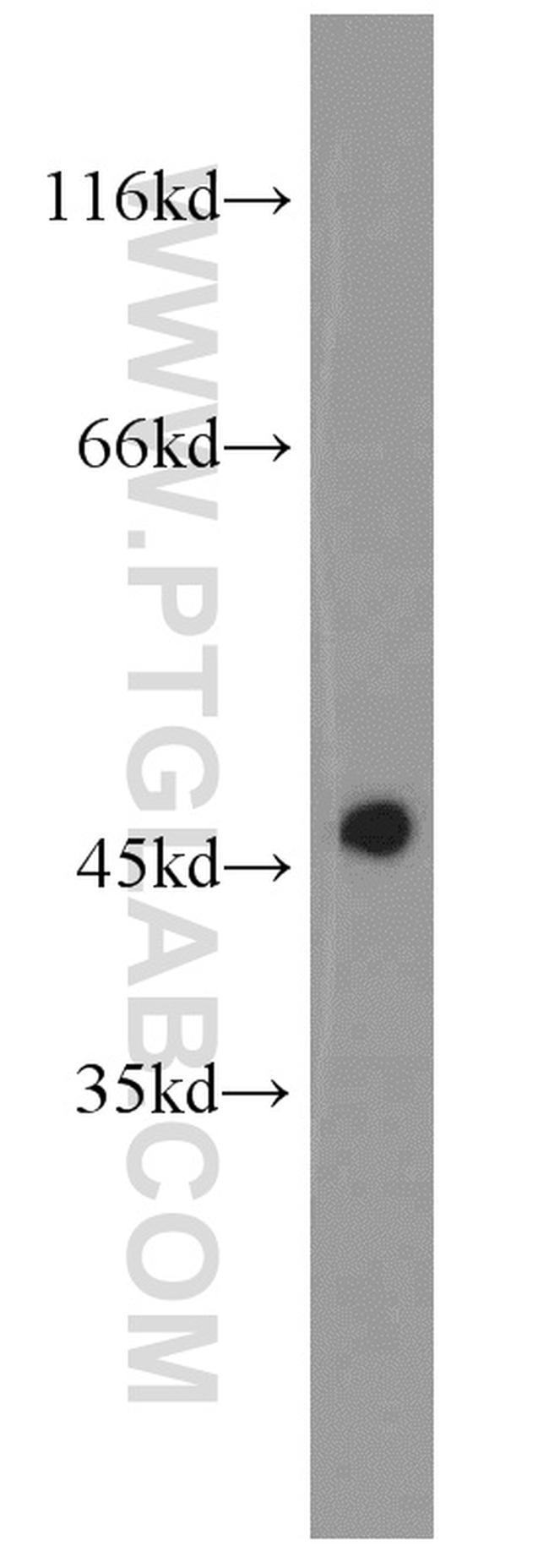 MAGT1 Antibody in Western Blot (WB)