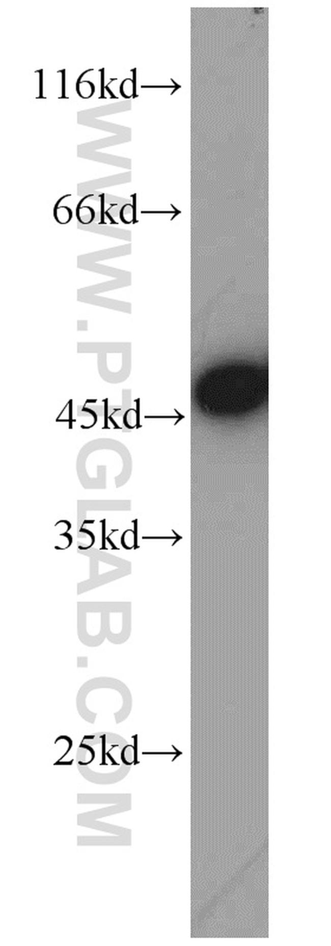 MAGT1 Antibody in Western Blot (WB)