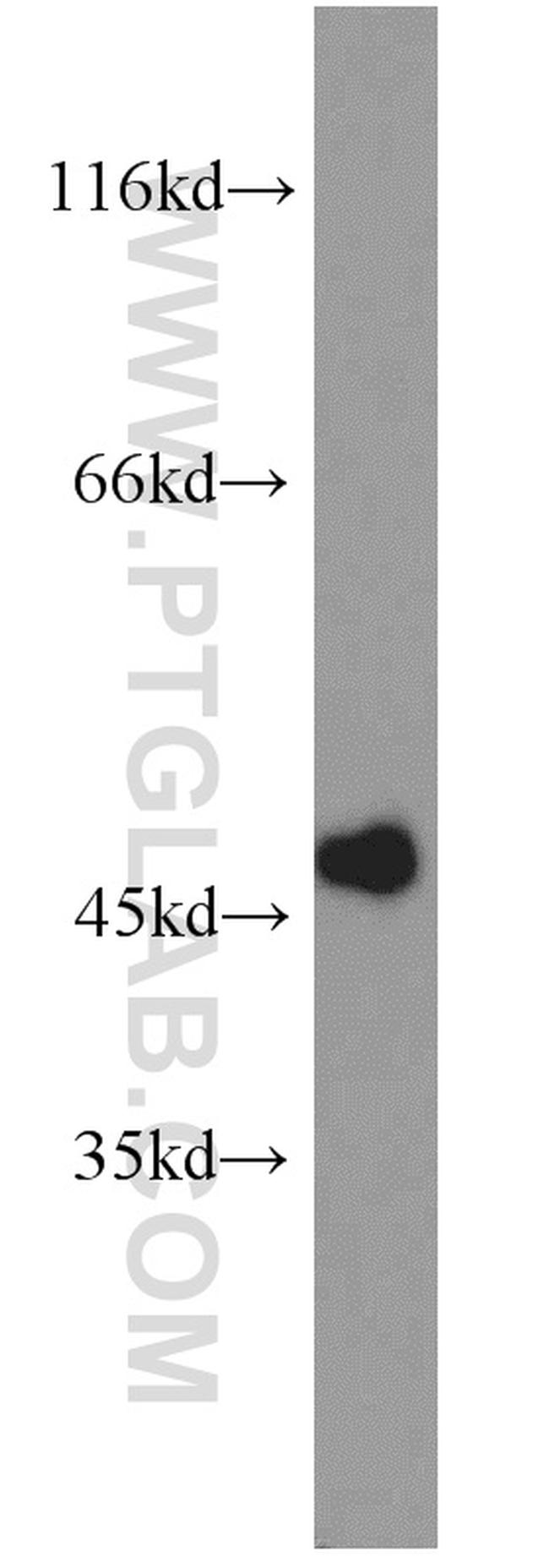 MAGT1 Antibody in Western Blot (WB)