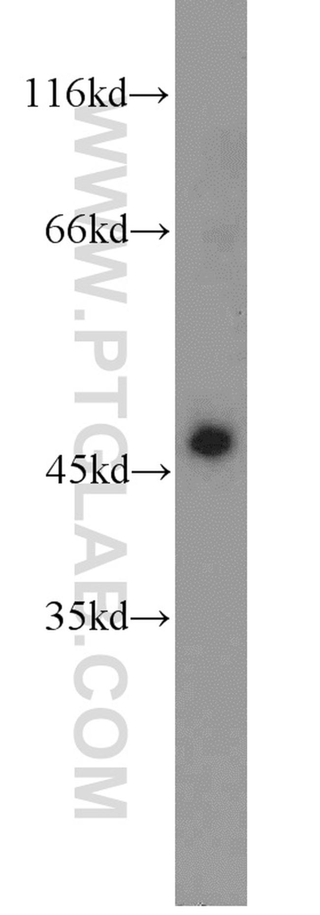 MAGT1 Antibody in Western Blot (WB)