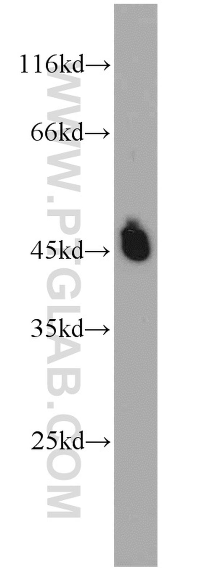 MAGT1 Antibody in Western Blot (WB)