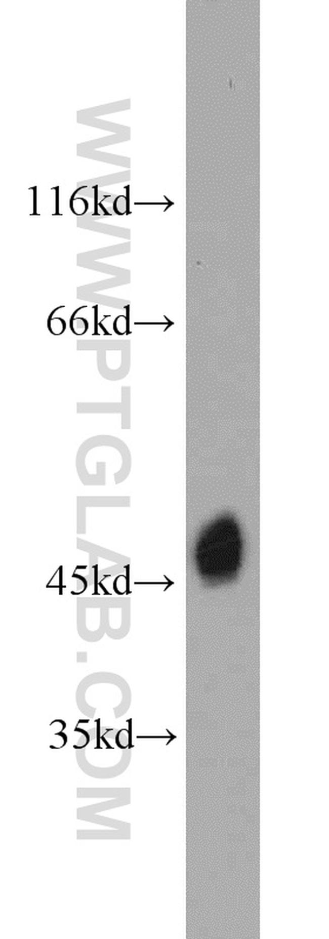 MAGT1 Antibody in Western Blot (WB)
