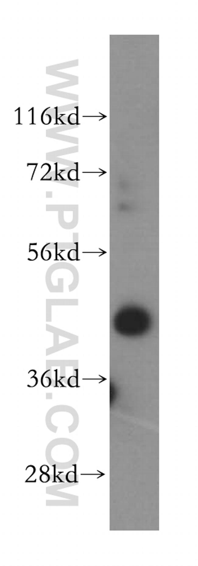 MAGT1 Antibody in Western Blot (WB)